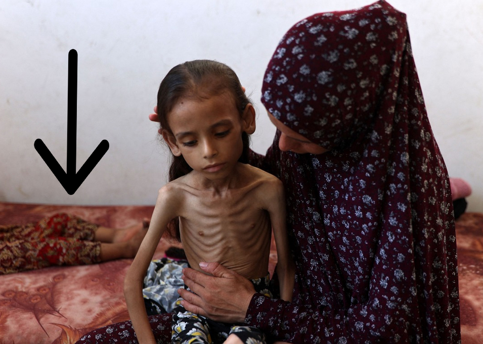 Famine - Maryam with sibling